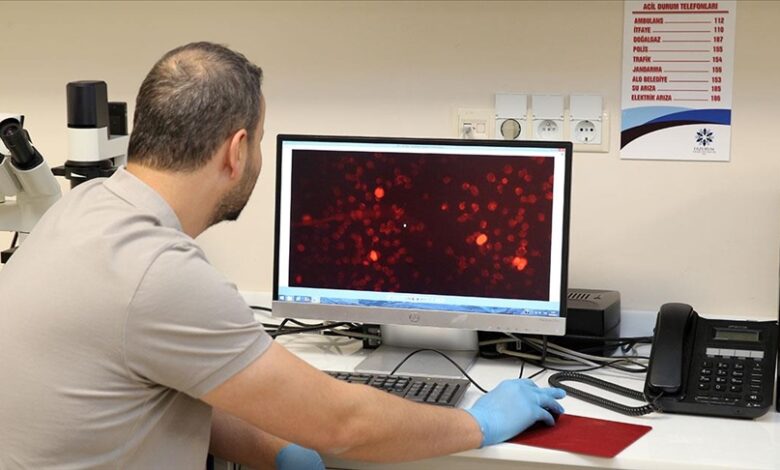 Akademisyenler, Alzheimer hastalığını kan tahliliyle erken teşhis için çalışıyor
