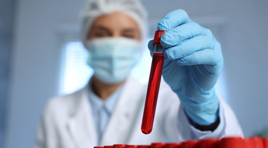 Kanseri belirtiler çıkmadan çok önce tespit edebilen kan testi geliştirildi Kanseri belirtiler çıkmadan çok önce tespit edebilen kan testi geliştirildi