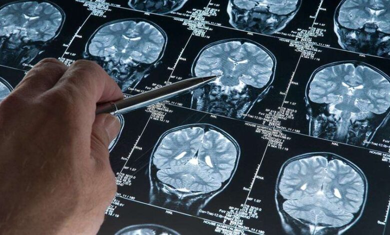 Alzheimer tedavisi virüslerde saklı olabilir mi?