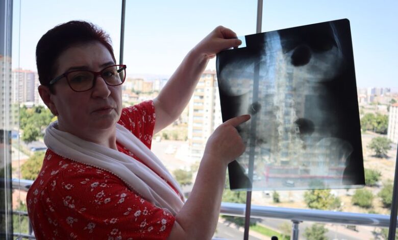 22 yıldır karnında ameliyat iğnesiyle yaşıyor