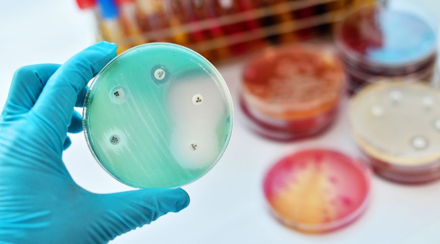 Yapay zeka, dirençli bakterilere karşı yeni antibiyotik tasarladı Yapay zeka, dirençli bakterilere karşı yeni antibiyotik tasarladı