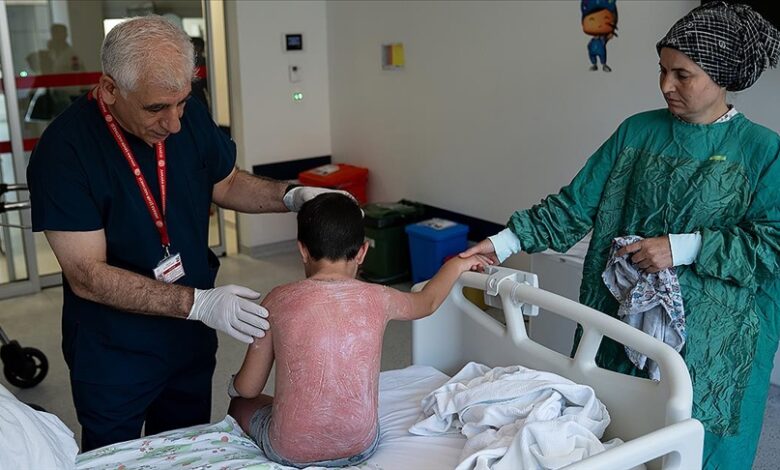 Güneşte 4 saat kalan çocuk, ikinci derece yanıkla hastanelik oldu Güneşte 4 saat kalan çocuk, ikinci derece yanıkla hastanelik oldu