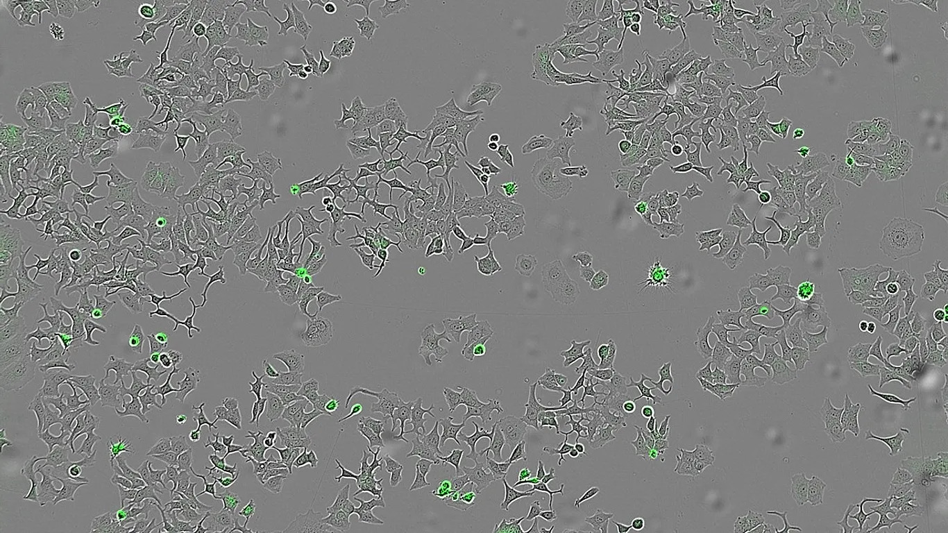 Umut verici çalışma: Bir bakteri türünün salgıladığı proteinle kanser hücreleri yok edildi