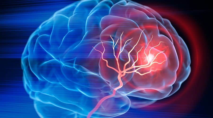 Prof. Dr. Semih Giray: 10 Adımda İnmeden Korunmanın Yolları