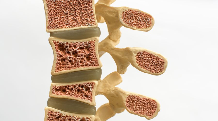 İnsan kemiklerinin derinliklerinde mikroplastik bulundu