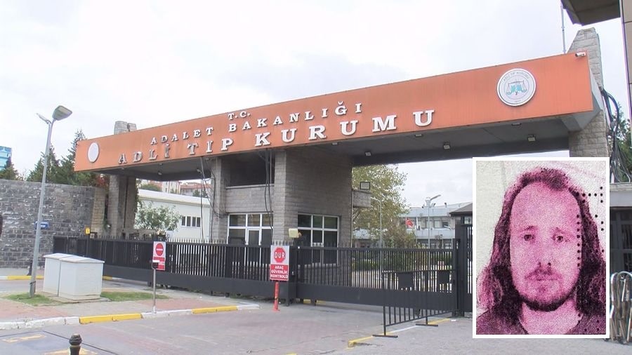 Saç Ekimi ve Diş Tedavisi İçin Türkiye’ye Gelen Turist…